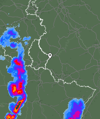 Radar