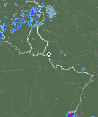 Radar