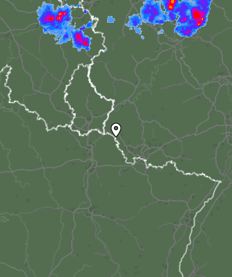 Radar