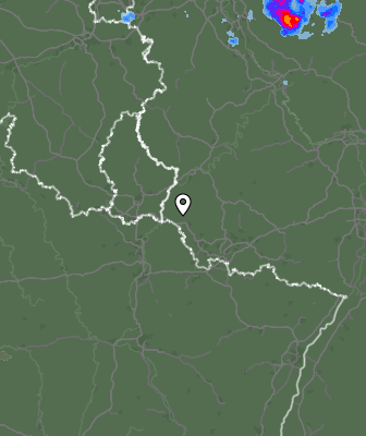 Radar