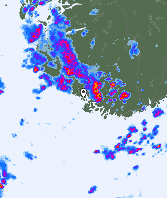 Radar