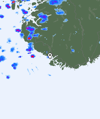 Radar