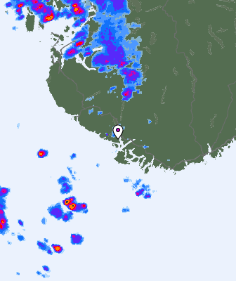 Radar