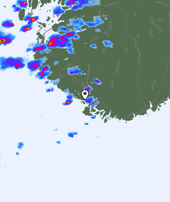 Radar