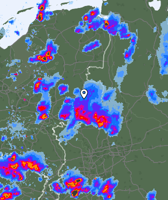 Radar