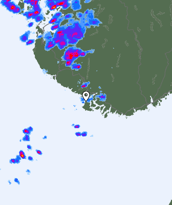 Radar