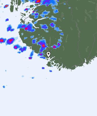 Radar