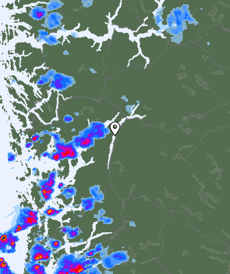 Radar