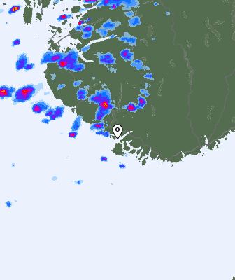 Radar