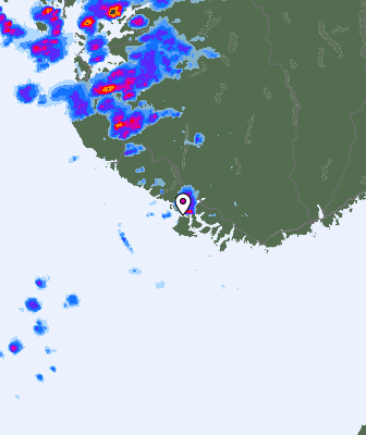 Radar