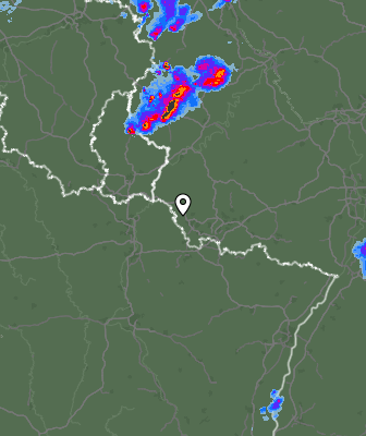 Radar