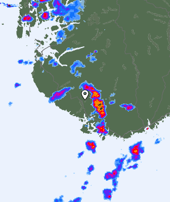 Radar