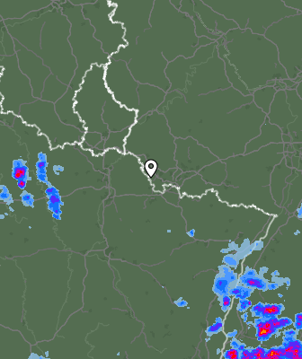 Radar
