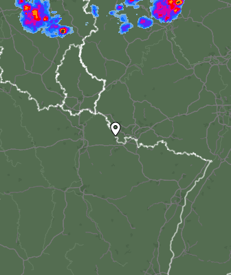 Radar