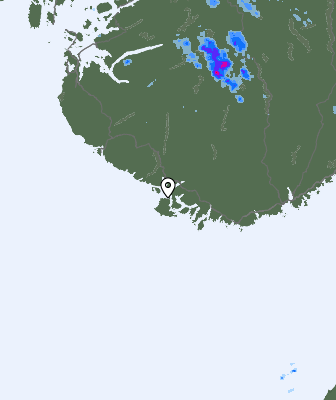 Radar