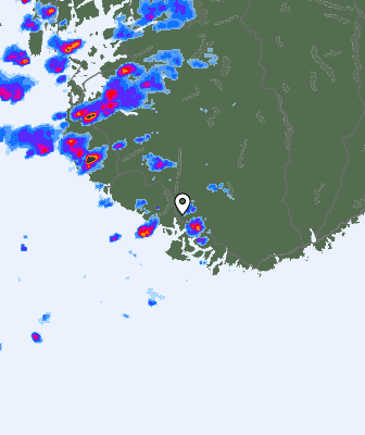 Radar