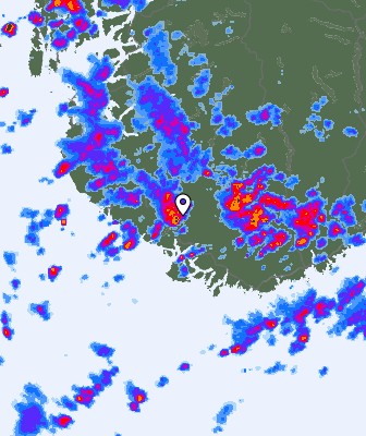 Radar