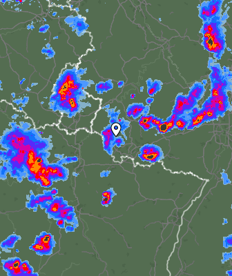Radar