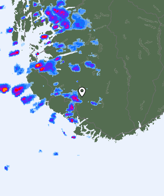 Radar