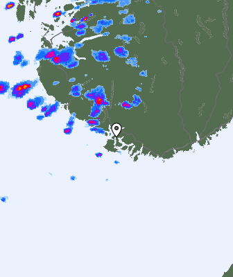 Radar