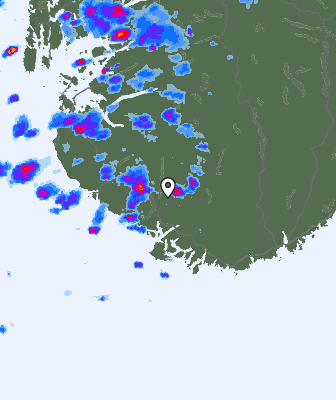 Radar