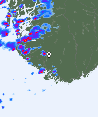 Radar