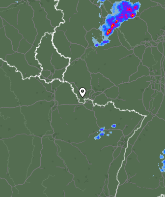 Radar