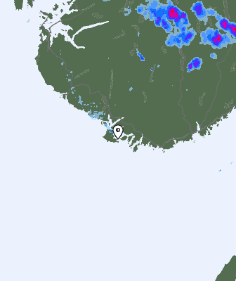Radar
