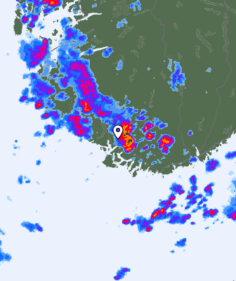 Radar