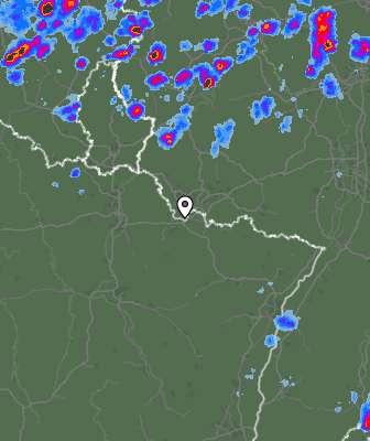 Radar