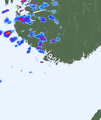 Radar