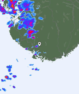 Radar