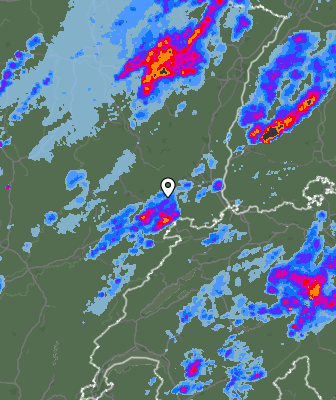 Radar