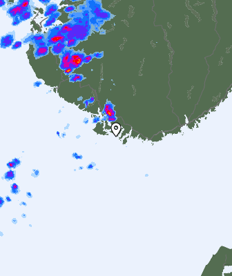 Radar