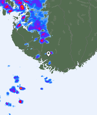 Radar