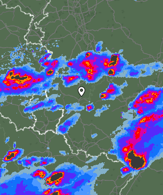 Radar