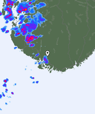 Radar