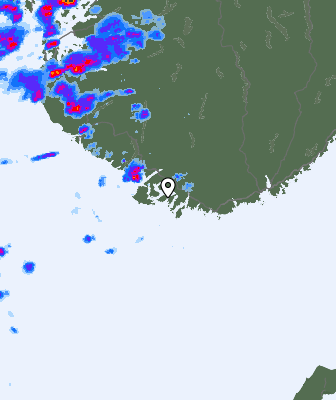 Radar