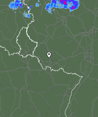 Radar