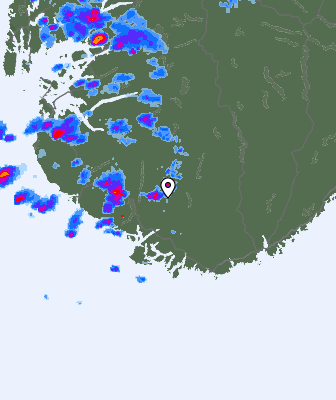 Radar