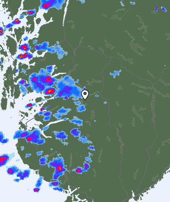 Radar