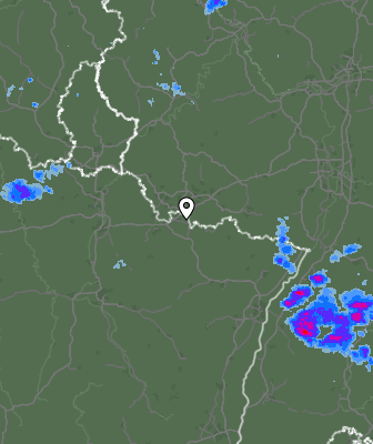 Radar
