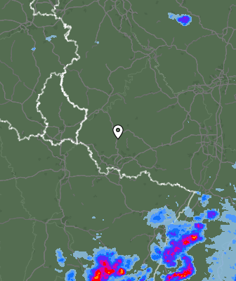 Radar