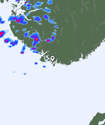 Radar
