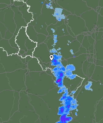 Radar