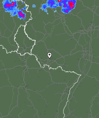 Radar