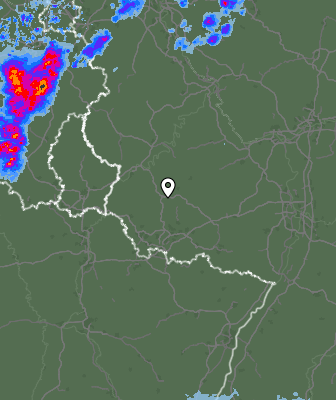 Radar