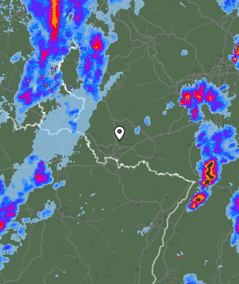 Radar