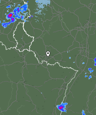 Radar
