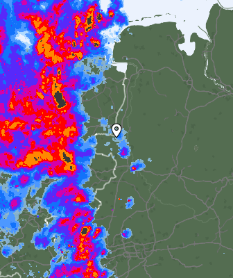 Radar